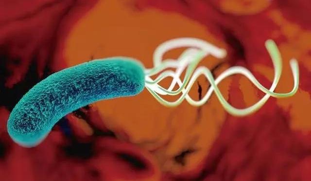 幽門螺桿菌被列為明確致癌物 中國成年人或有50%感染率